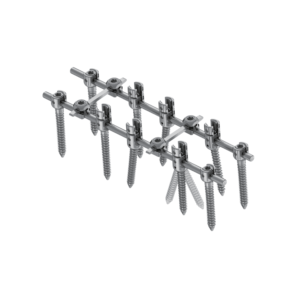 KSS-II 5.5 Spinal Fixation System (Posterior Fixation)
