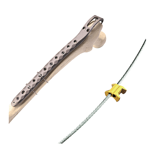 Titanium Cable System